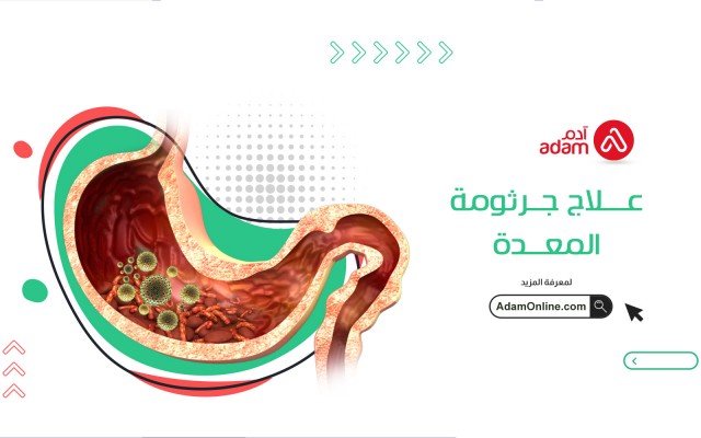 علاج جرثومة المعدة